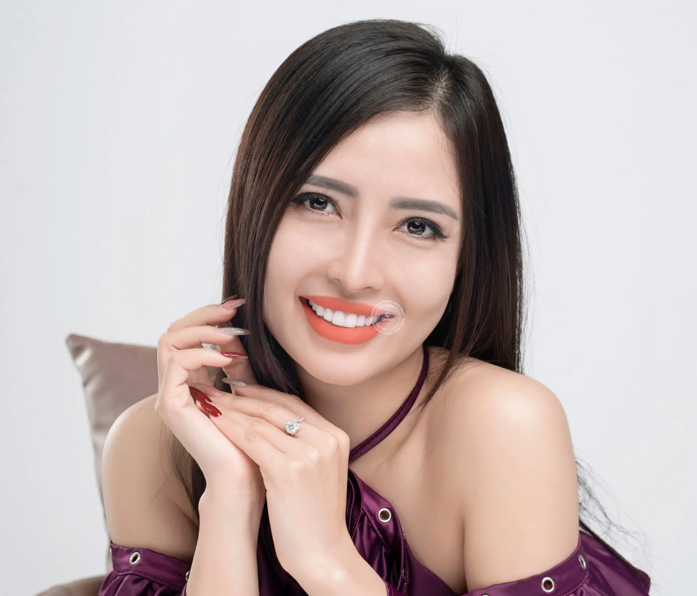 Răng sứ Lava Esthetic: Bí mật đằng sau nụ cười tự nhiên hoàn hảo